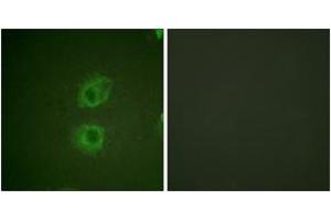 Immunofluorescence analysis of HuvEc cells, using HER3 (Ab-1222) Antibody.