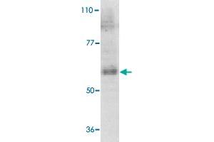 Western blot analysis of IL21R expression in human Raji cell lysate with IL21R polyclonal antibody  at 1 ug /mL . (IL21 Receptor Antikörper  (AA 97-111))