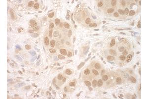 anti-Nuclear Cap Binding Protein Subunit 2 (NCBP2) (AA 1-50) antibody