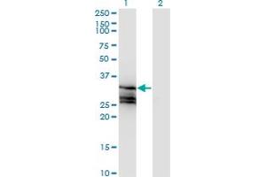 Western Blot analysis of HAGH expression in transfected 293T cell line by HAGH monoclonal antibody (M02A), clone 2F9. (HAGH Antikörper  (AA 161-260))