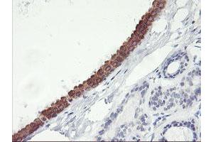 Immunohistochemical staining of paraffin-embedded Human breast tissue using anti-C20orf3 mouse monoclonal antibody. (APMAP Antikörper)