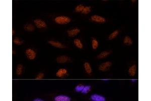 Immunofluorescence analysis of U-2 OS cells using ADNP Polyclonal Antibody at dilution of 1:100 (40x lens). (ADNP Antikörper)
