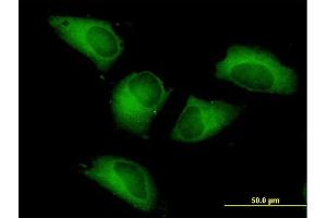 Immunofluorescence of purified MaxPab antibody to PFKP on HeLa cell. (PFKP Antikörper  (AA 1-784))