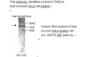 Image no. 1 for anti-Heat Shock 70kDa Protein 5 (Glucose-Regulated Protein, 78kDa) (HSPA5) antibody (ABIN790797) (GRP78 Antikörper)