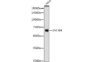 Western blot analysis of extracts of HeLa cells, using ZNF384 antibody (ABIN7271478) at 1:1000 dilution. (ZNF384 Antikörper  (AA 1-180))