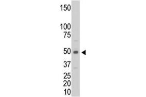 Western Blotting (WB) image for anti-Creatine Kinase, Muscle (CKM) antibody (ABIN3002974) (CKM Antikörper)