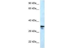 Western Blot showing MMACHC antibody used at a concentration of 1 ug/ml against U937 Cell Lysate