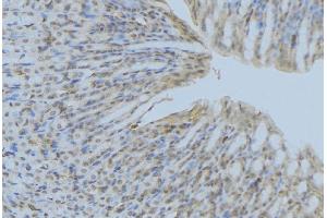 ABIN6277248 at 1/100 staining Human gastric tissue by IHC-P. (ACP5 Antikörper  (N-Term))