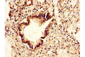 IHC image of ABIN7147557 diluted at 1:400 and staining in paraffin-embedded human lung tissue performed on a Leica BondTM system. (CHI3L2 Antikörper  (AA 27-390))