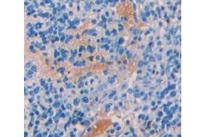 Used in DAB staining on fromalin fixed paraffin- embedded Kidney tissue (CBL Antikörper  (AA 558-816))