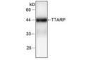 Image no. 1 for anti-tyrosyl-DNA phosphodiesterase 2 (TDP2) antibody (ABIN791474) (TDP2 Antikörper)
