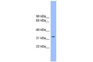 WB Suggested Anti-SLC25A1 Antibody Titration:  0. (Slc25a1 Antikörper  (Middle Region))