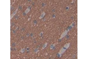 IHC-P analysis of Human Tissue, with DAB staining. (TWSG1 Antikörper  (AA 26-223))