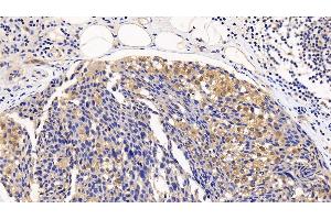 Immunohistochemistry (IHC) image for anti-Eukaryotic Translation Initiation Factor 4E Binding Protein 1 (EIF4EBP1) (AA 2-118) antibody (ABIN7436819)