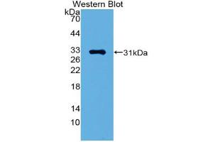 Western blot analysis of the recombinant protein. (GATA1 Antikörper  (AA 42-292))