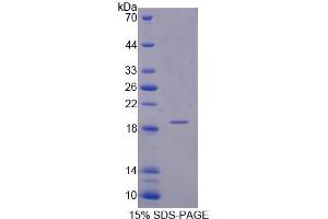 SDS-PAGE (SDS) image for Inositol Polyphosphate-4-Phosphatase, Type I, 107kDa (INPP4A) (AA 1-137) protein (His tag) (ABIN4990940)