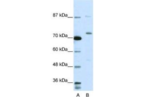 Western Blotting (WB) image for anti-Exosome Component 10 (EXOSC10) antibody (ABIN2462060)