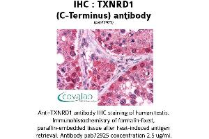 Image no. 2 for anti-Thioredoxin Reductase 1 (TXNRD1) (C-Term) antibody (ABIN1740489) (TXNRD1 Antikörper  (C-Term))