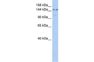 UGCGL2 antibody used at 1 ug/ml to detect target protein. (UGCGL2 Antikörper  (N-Term))