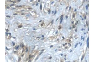Immunohistochemistry (IHC) image for anti-Transforming Growth Factor, alpha (TGFA) (AA 24-98) antibody (ABIN7425710)
