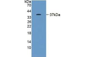 Western blot analysis of recombinant Human KEAP1. (KEAP1 Antikörper  (AA 327-624))