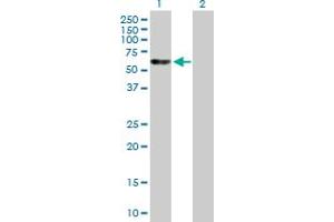 Western Blot analysis of EED expression in transfected 293T cell line by EED MaxPab polyclonal antibody. (EED Antikörper  (AA 1-441))
