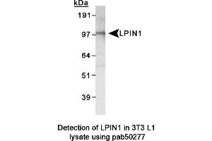 Image no. 2 for anti-Lipin 1 (LPIN1) (AA 300-400), (Internal Region) antibody (ABIN363586) (Lipin 1 Antikörper  (Internal Region))