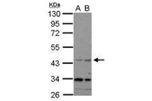 Image no. 1 for anti-CHRNA7 (Cholinergic Receptor, Nicotinic, alpha 7, Exons 5-10) and FAM7A (Family with Sequence Similarity 7A, Exons A-E) Fusion (CHRFAM7A) (AA 1-177) antibody (ABIN1497505)