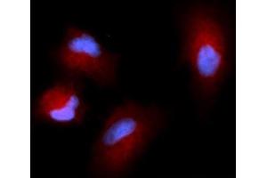 Immunofluorescence (IF) image for anti-Cystatin SN (CST1) (AA 21-141) antibody (APC) (ABIN5568436) (CST1 Antikörper  (AA 21-141) (APC))