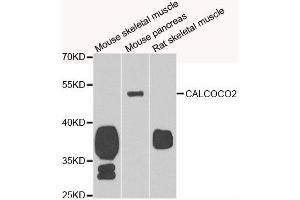 Western blot analysis of extracts of various cell lines, using CALCOCO2 antibody. (CALCOCO2 Antikörper)