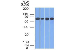 Western Blot of HT20, A549, 293 and A431 cell lysates using C Catenin, gamma Mouse Monoclonal Antibody (11E4). (JUP Antikörper)