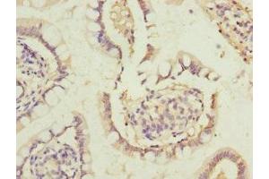 Immunohistochemistry of paraffin-embedded human small intestine tissue using ABIN7172381 at dilution of 1:100