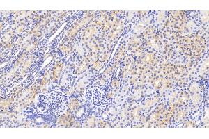 Detection of GSS in Human Kidney Tissue using Polyclonal Antibody to Glutathione Synthetase (GSS) (Glutathione Synthetase Antikörper  (AA 268-474))