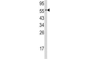 Western Blotting (WB) image for anti-Cell Division Cycle 23 (CDC23) antibody (ABIN3002712) (CDC23 Antikörper)