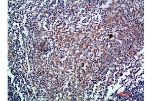 Immunohistochemistry (IHC) image for anti-Endoglin (ENG) (AA 370-430) antibody (ABIN7189493)