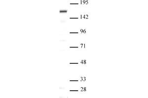 SIP1 antibody (pAb) tested by Western blot Nuclear extract of Saos-2 cells (20 μg per lane) probed with SIP1 antibody (pAb) at a dilution of 1:500. (SIP1 Antikörper  (N-Term))