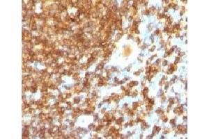 IHC test of FFPE human tonsil probed with CD45RB antibody (PTPRC/1132).