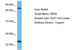 Western Blotting (WB) image for anti-GTPase Kras (KRAS) (N-Term) antibody (ABIN2786191)