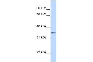 Western Blotting (WB) image for anti-Guanine Nucleotide Binding Protein (G Protein), beta Polypeptide 1 (GNB1) (C-Term) antibody (ABIN2785814)