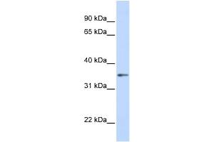 WB Suggested Anti-GNB1 Antibody Titration: 0. (GNB1 Antikörper  (C-Term))