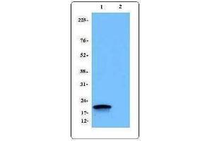 Western Blotting (WB) image for anti-CD247 Molecule (CD247) antibody (ABIN2664433) (CD247 Antikörper)