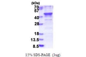 BRISC and BRCA1 A Complex Member 1 (BABAM1) (AA 1-329) protein (His tag)