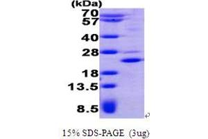 SDS-PAGE (SDS) image for Pleckstrin Homology-Like Domain, Family A, Member 2 (PHLDA2) (AA 1-152) protein (His tag) (ABIN7529145)