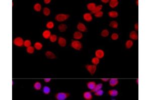 Immunofluorescence analysis of HeLa cells using CYBA Polyclonal Antibody at dilution of 1:100 (40x lens). (CYBA Antikörper)