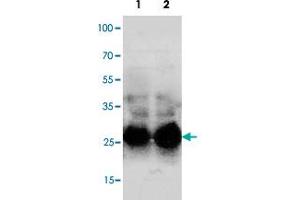 Western blot analysis of mouse lung with Sftpa1 polyclonal antibody . (Surfactant Protein A1 Antikörper  (C-Term))