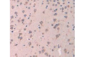 IHC-P analysis of Mouse Tissue, with DAB staining. (ESM1 Antikörper  (AA 22-184))