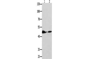 Gel: 10 % SDS-PAGE, Lysate: 40 μg, Lane 1-2: Hela cells, 293T cells, Primary antibody: ABIN7191756(P2RY11 Antibody) at dilution 1/500, Secondary antibody: Goat anti rabbit IgG at 1/8000 dilution, Exposure time: 1 minute (P2RY11 Antikörper)