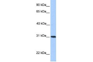 WB Suggested Anti-HELT Antibody Titration:  0. (HELT Antikörper  (Middle Region))