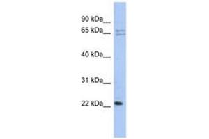 Image no. 1 for anti-Ribosomal Protein L18 (RPL18) (N-Term) antibody (ABIN6743981)