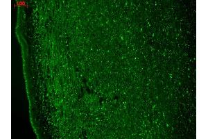 Immunohistochemistry analysis using Mouse Anti-CaV3. (CACNA1H Antikörper  (AA 1019-1293) (APC))
